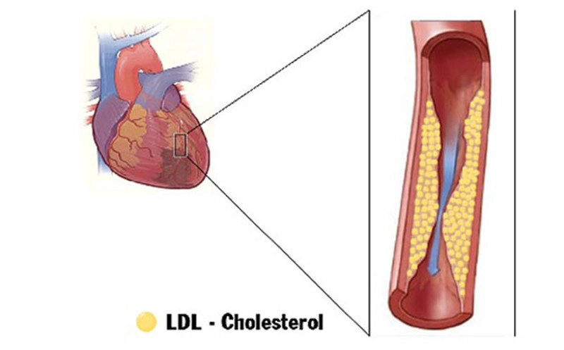 Saponin trong rau đắng loại bỏ cholesterol xấu, ngăn ngừa xơ vữa động mạch, tăng cường sức khỏe bà bầu.